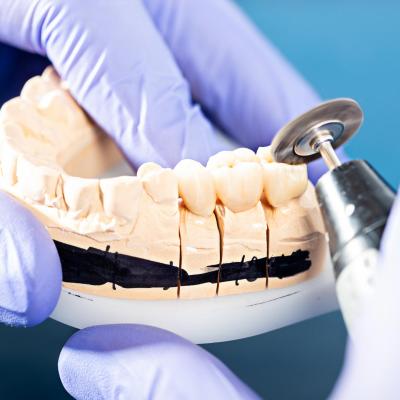 Aufnahme einer Zahnmodellage 1